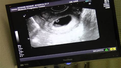 This is about the time that a scan can pick up your baby's heart beat for the first time. 8 Week Ultrasound! - Baby #4 - YouTube