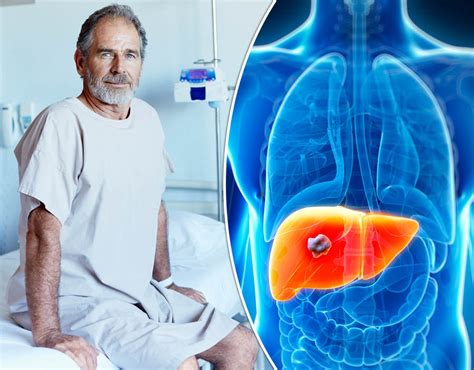Signs And Symptoms Of Liver Cancer Pictures Pics Uk