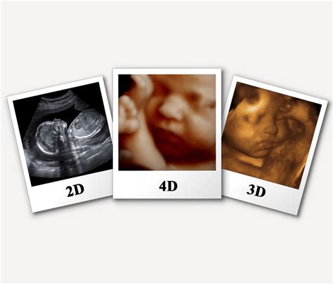 Pin On 3d And 4d Ultrasound