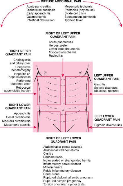 Medical Abdominal Pain Quadrant Wise