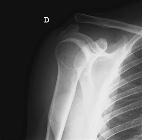 Simple Science: How to Make a Volcano with Kids