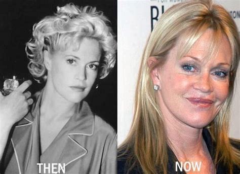 Jackman and furness continued their relationship offscreen, and the two were married in 1996. Melanie Griffith How plastic surgery can destroy real beauty?