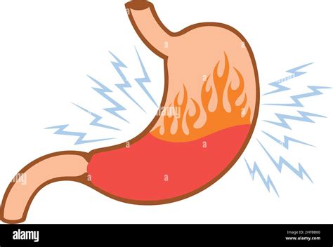 Human Internal Stomach Heartburn Problems Concept Vector Illustration