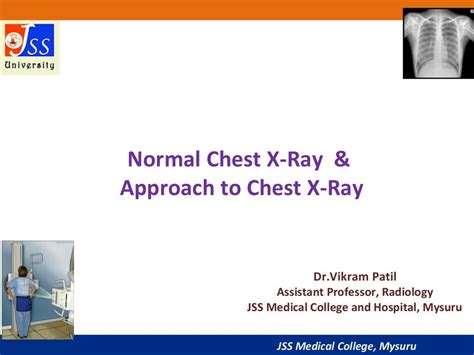 Approach To Chest X Ray And Interpretation