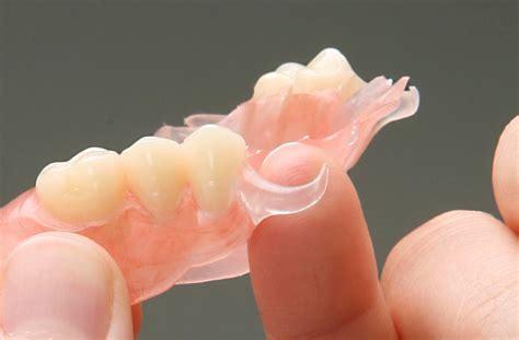 Flexible Partials Dental Prosthetic Services