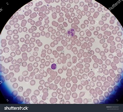 Human Blood Smear Normal Red BloodẢnh Có Sẵn596353457 Shutterstock