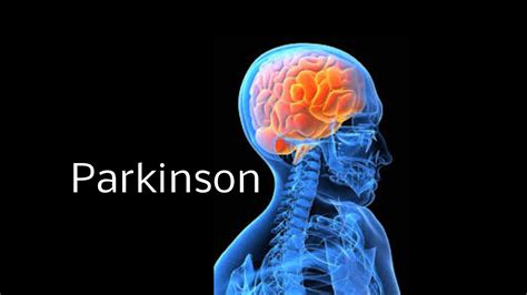 Parkinson Ursachen Arten Symptome Diagnose Und Behandlung