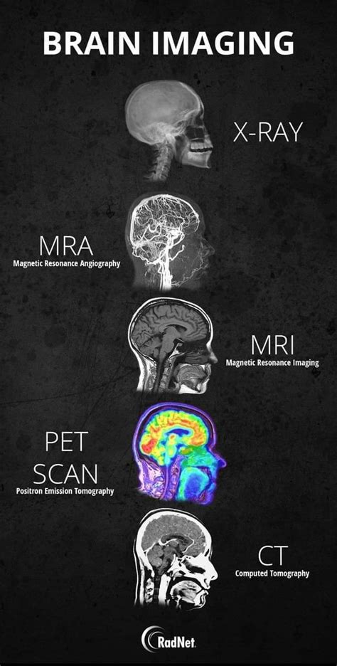Guide To Different Types Of Brain Imaging Coolguides