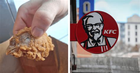Picture Of Fried Chicken Head In Kfc Customer S Hot Wing Meal Goes