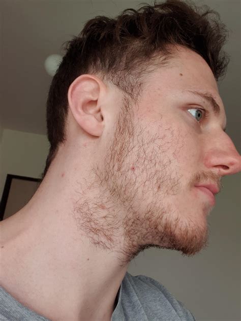 need advice is this facial hair density enough for developing full beard if i let it grow now