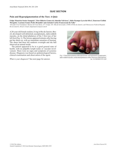 Pdf Pain And Hyperpigmentation Of The Toes A Quiz