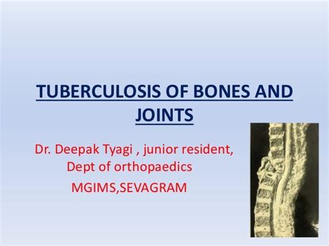 Tuberculosis Of Bone And Joints