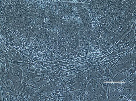 Researchers Successfully Convert Human Skin Cells Into Embryonic Stem Cells