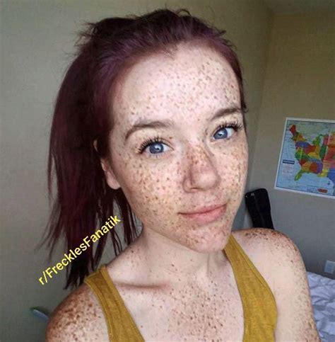 Freckled Freckles Scrolller