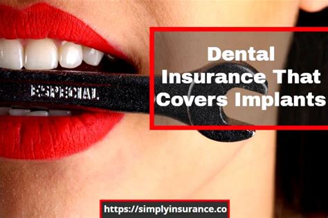 The dental insurance shop offers two companies that will cover dental implants with no waiting period! Dental Insurance That Covers Implants With No Waiting Period » Dental News Network