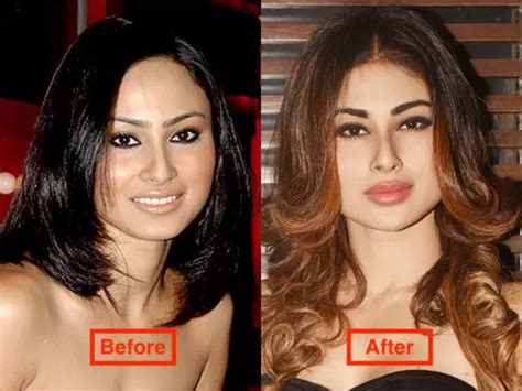 16 Actresses Who Have Undergone Plastic Surgery See Pics