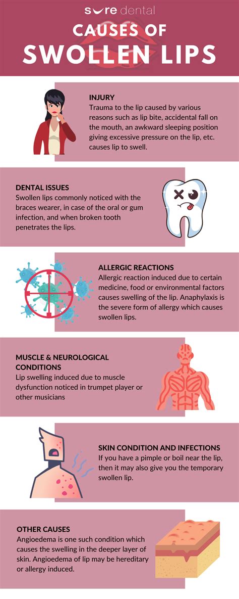 What Are Swollen Lips Causes And Treatment Infographic Sure Dental