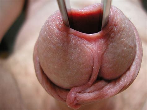 Urethra Insertion