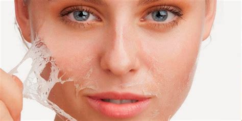 Information On Skin Peeling Causes And Prevention