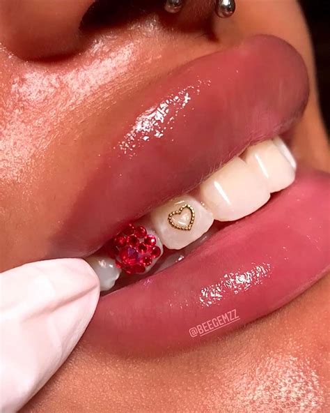 Ig Beegemzz Smile Aesthetics Specialist Tooth Jewels Tooth Gems