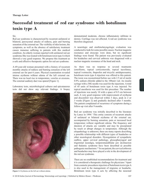 Pdf Successful Treatment Of Red Ear Syndrome With Botulinum Toxin Type A