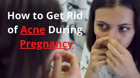 How To Get Rid Of Acne During Pregnancy Acne During Pregnancy Treatment Youtube