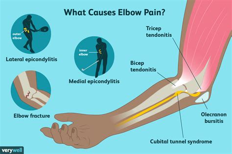 Elbow Pain Causes Treatment And When To See A Healthcare Provider