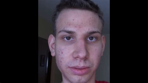 Incels seem drawn to braincels and incels.co based on a sense that their looks or other personal traits most of the incels i know are around 16 to 30 years old. R.I.P. incel forum guy - YouTube