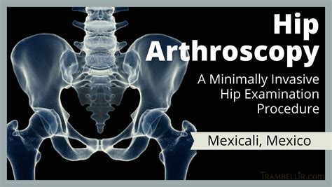 Hip Arthroscopy A Minimally Invasive Hip Examination Procedure