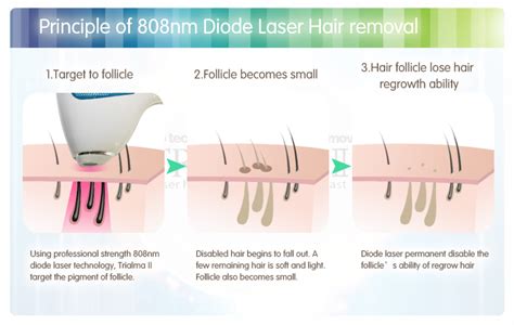 Laser Hair Removal For Dark Skin At Home Whats The Best Way To Do It
