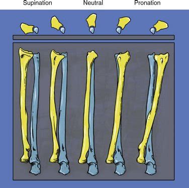 Stability Of The Distal Radioulnar Joint Clinical Gate