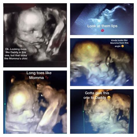 Style:our little present sonogram ornament. Another sonogram picture from one of our patients! "I ...
