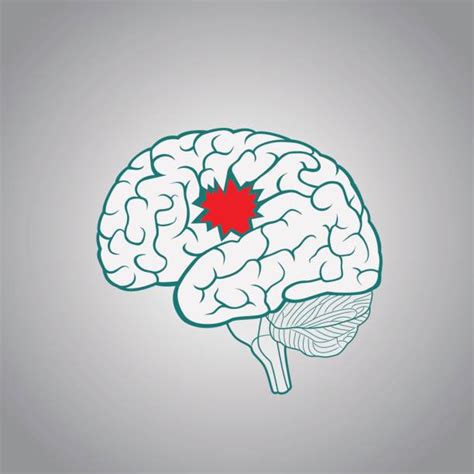 Brain Damage Illustrations Royalty Free Vector Graphics And Clip Art