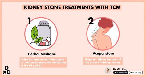 How Do Doctors Check For Kidney Stones