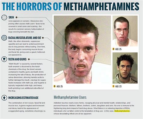 Meth Addicts Transformation After Being Drug Free For 90 Days Daily