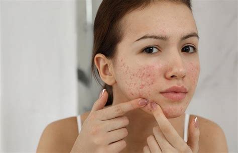 Skin Inflammation Causes Symptoms Diagnosis And Treatment