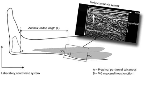 Learn more from webmd about achilles tendon injuries, including their causes, symptoms, diagnosis, treatment, and prevention. Schematic representation of two coordinate systems ...