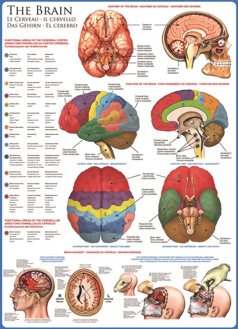 A strain is an injury to a muscle or tendon (cords of tissue connecting muscle to bone). EuroGraphics Human Body (The Brain) 1000-Piece Puzzle. The ...