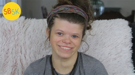 Living With Williams Syndrome A Condition That Makes You Friendly