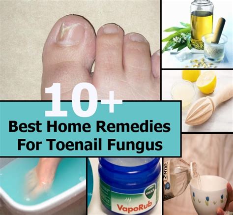 10 Best Home Remedies For Toenail Fungus Diy Home Things