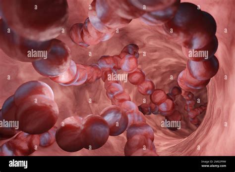 Strep A In Children Hi Res Stock Photography And Images Alamy