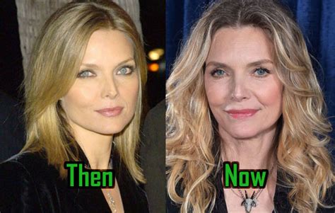 Michelle Pfeiffer Plastic Surgery Creates Age Defying Face Before