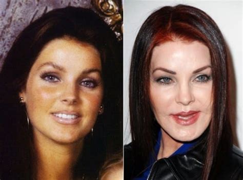 Priscilla Presley Plastic Surgery Photo Before And After Celeb