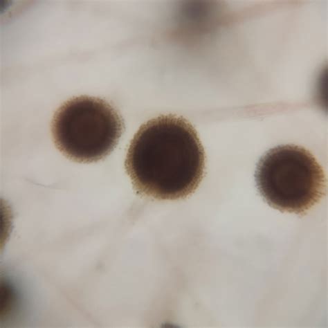 Aspergillus Sp Whole Mount Prepared Slides