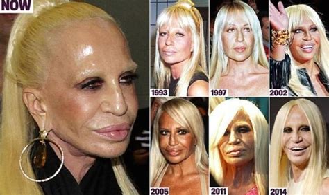 Celebrities Who Destroyed Themselves With Plastic Surgery Ready Set He Donatella Versace