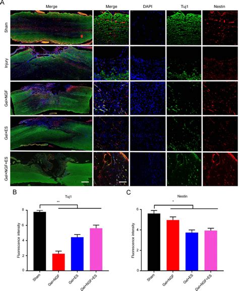 Investigation On NSCs Differentiate Into Neurons In Vivo A Analysis Of