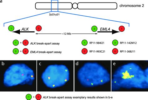 Schematic Design Of The Break Apart Fish Assays And Exemplary Findings