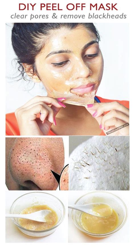 Blackheads Are Small And Dark Spots That Appear On The Skin Once The