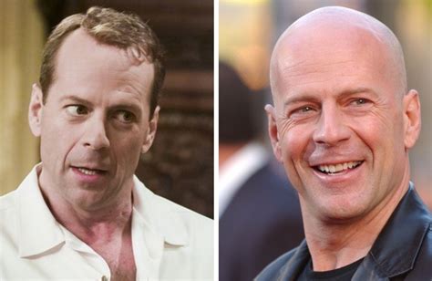 19 Bald Celebrities Before And After Embracing Baldness