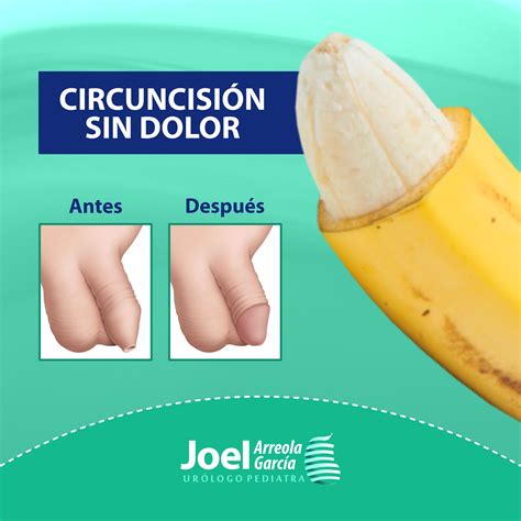 Un Pene Que Tiene La Circuncisión Es Urólogo Pediatra